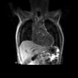 Dynamic imaging sequence