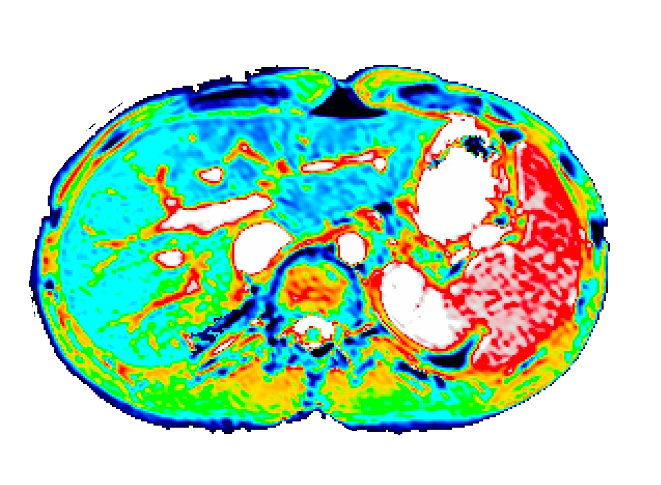 Liver imaging