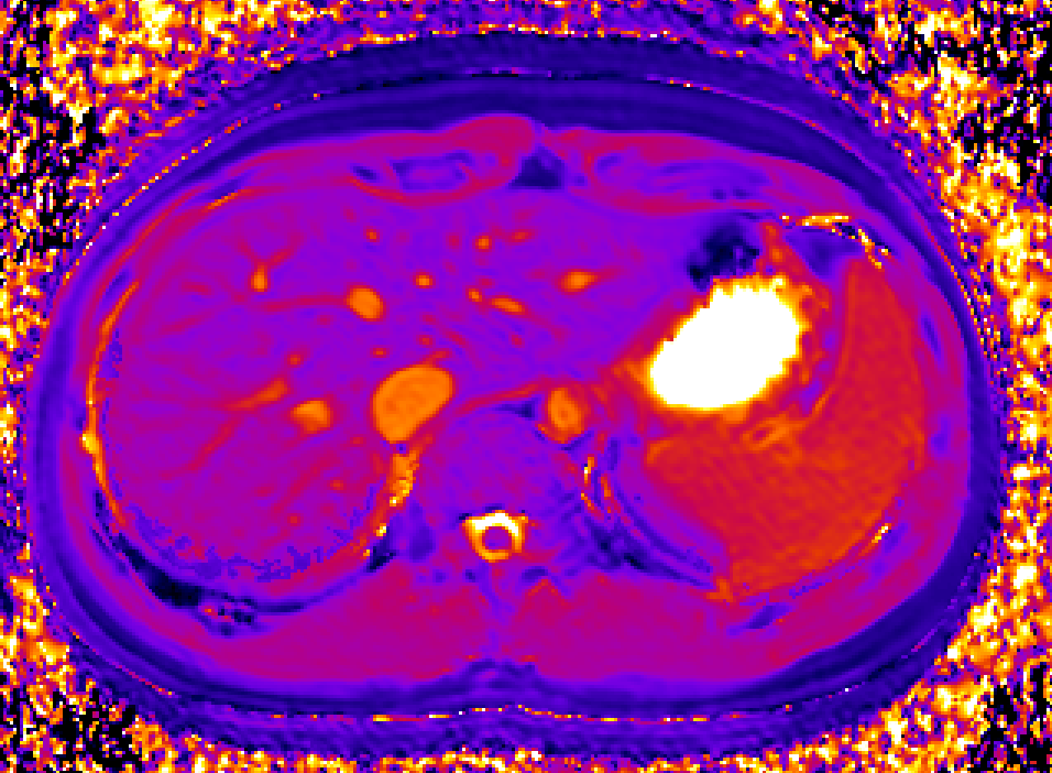 Liver transporter imaging
